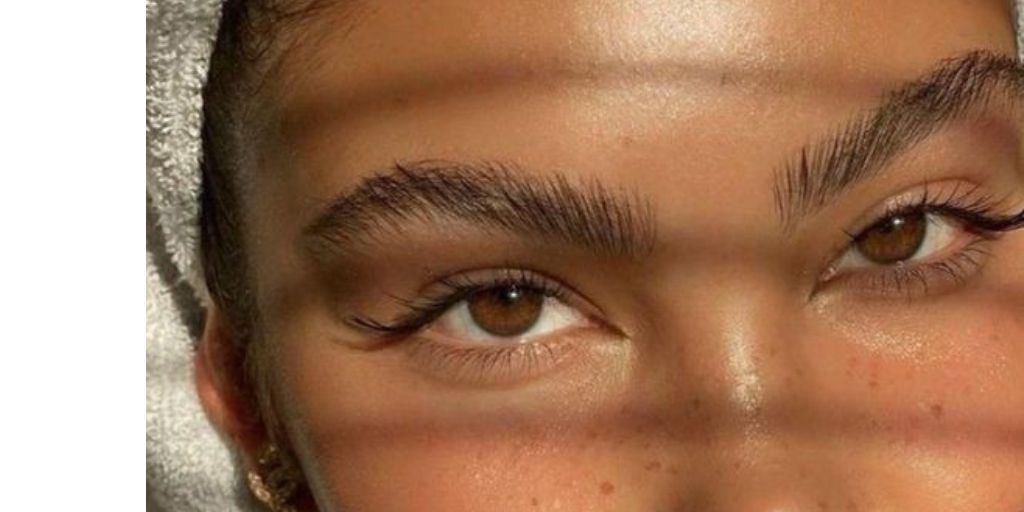 Fine Lines Around The Eyes: Causes and Tips
