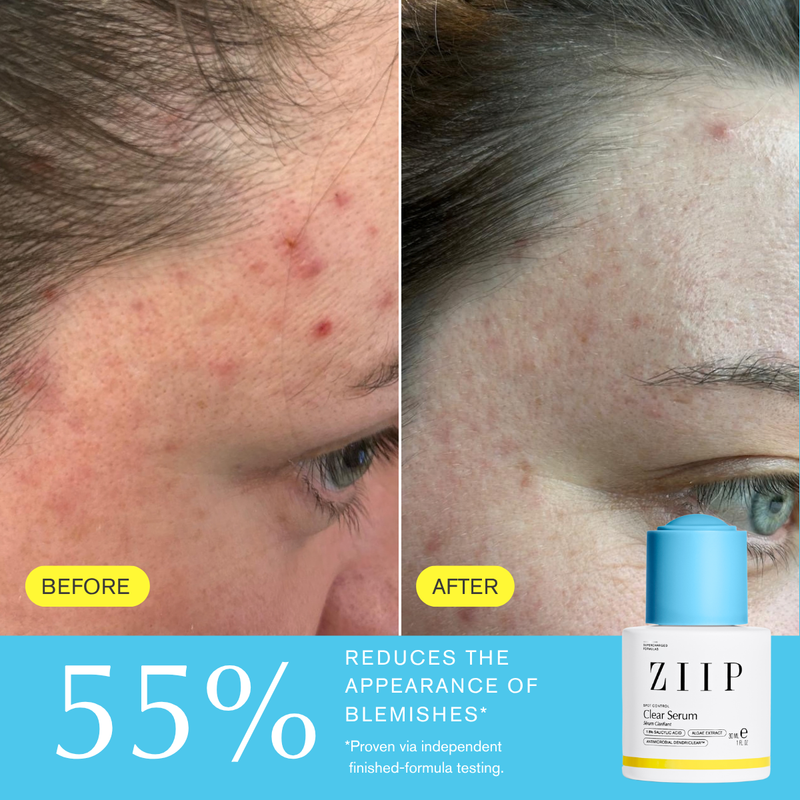 Clear Salicylic Acid Serum