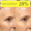 Before-and-after close-up of an older woman's eye area showing reduced wrinkles.